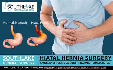 Hiatal Hernia Stomach Hernia Diagnosis And Treatment