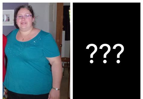 the 10 things nobody tells you about weight loss surgery melissa loses it