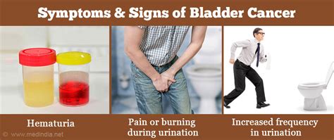 Some symptoms of bladder infection overlap with those of bladder cancer, but due to individual differences, it is not enough for an individual to tell the difference without formal diagnostic testing. Bladder Cancer - Symptoms, Signs, Diagnosis, Treatment ...