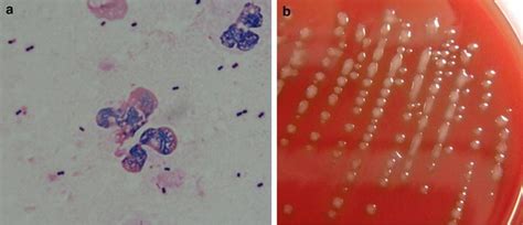 Invasive Pneumococcal Disease Caused By Mucoid Serotype 3 Streptococcus