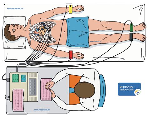 Electrocardiograma sau ECG ce este și când trebuie efectuată RODOCTOR MEDICAL CENTER