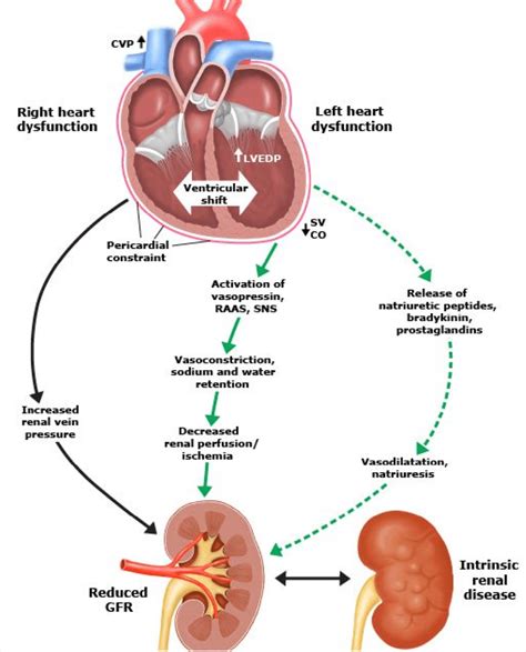 Kidney Schematic