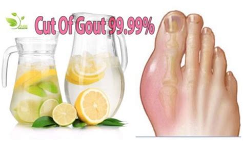How To Get Rid Of A Gout Attack