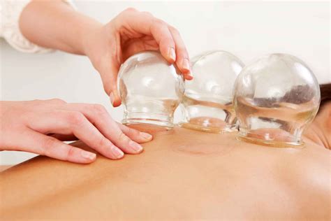 Cupping Therapy Yan Acupuncture And Herbs Authentic Traditional