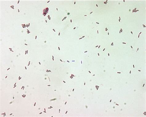 Free Picture Clostridium Genus Anaerobic Spore Forming Bacteria