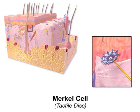 What Is Merkel Cell Carcinoma Southeast Radiation Oncology Group P