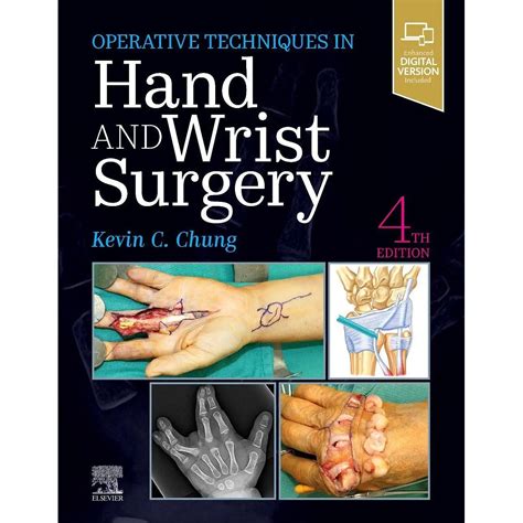 Operative Techniques Hand And Wrist Surgery