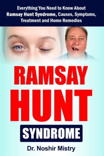 Ramsay Hunt Syndrome Everything You Need To Know About Ramsay Hunt