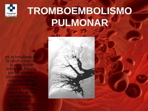 Ppt Tromboembolismo Pulmonar Es El Resultado De La Obstrucci N De La