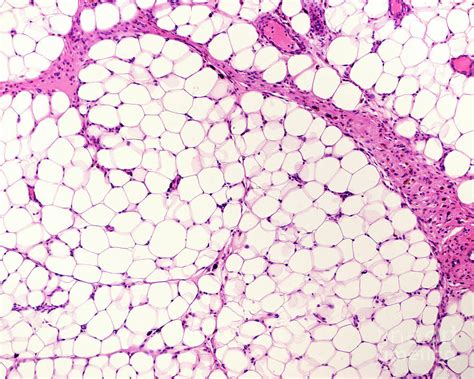 White Adipose Tissue Photograph By Jose Calvo Science Photo Library