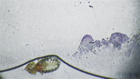 Head Lice Under The Microscope Skin Flea Under Magnification The