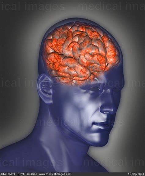 Stock Image Illustration Of A Brain Inside The Skull Of A Man 111418