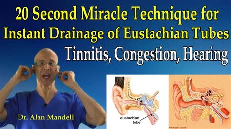 20 Second Miracle Technique For Instant Drainage Of Eustachian Tubes Tinnitis Congestion