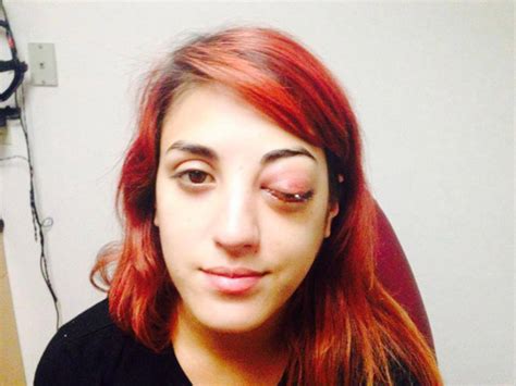 Eyes Set To Kill Bassist Anissa Rodriguez Released From Hospital