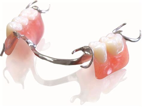 Partial Dentures In Phoenix Az 85014 Central Valley Dentistry