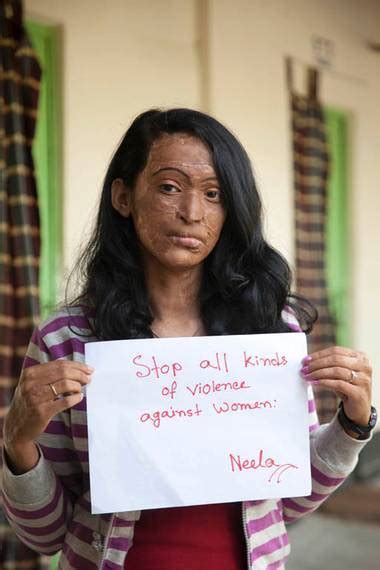 approachingsignificance acid attack survivors we speak for earth