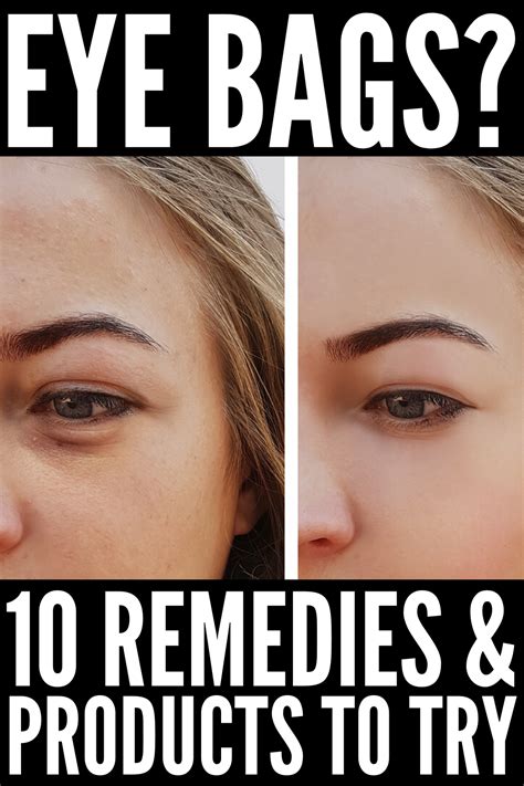 How To Get Rid Of Eye Bags 10 Tips And Tricks That Work Eye Bags