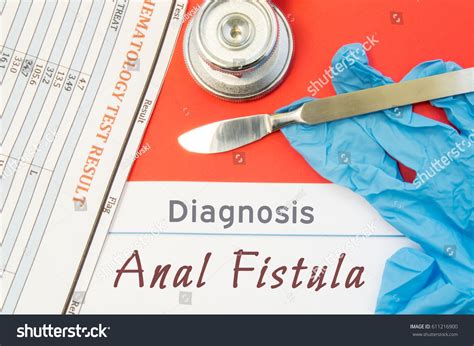 Surgical Diagnosis Anal Fistula Surgical Medical Stock Photo Shutterstock
