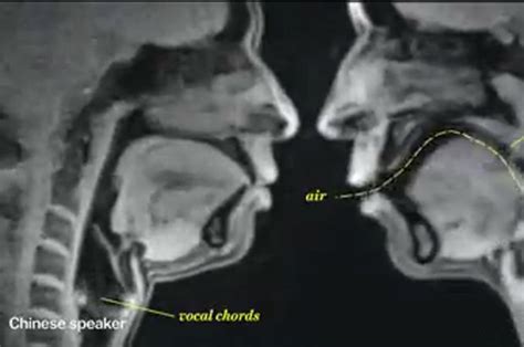 Watch Couples Having Sex In Mri Scanner Video Goes Viral CLOUDYX GIRL