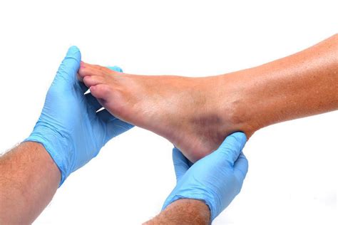 How To Keep A Sprained Ankle From Turning Into Chronic Instability