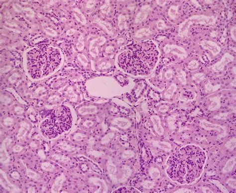 Renal Medulla Histology Kidney