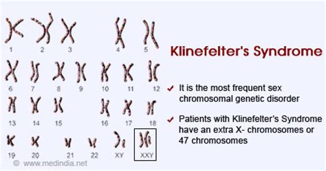 Health Tip On Klinefelter S Syndrome Health Tips