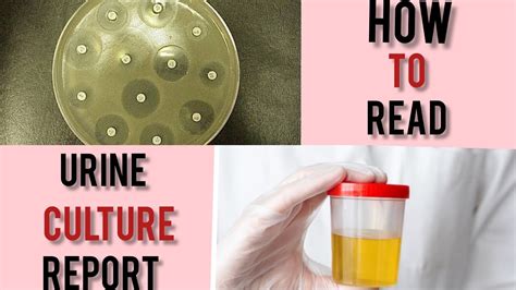 How To Read Urine Culture Report