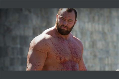 The Mountain S Face From Game Of Thrones Is More Gruesome Than You