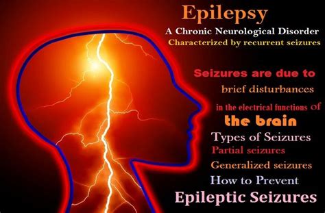 Epilepsy Symptoms Causes And Treatments How To Prevent Epileptic