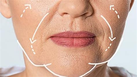 What Causes Sagging Jowls And How To Tighten The Jawline Dc Aesthetics