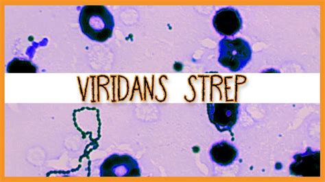 Viridans Streptococci S Mutans S Mitis S Sanguinis Youtube