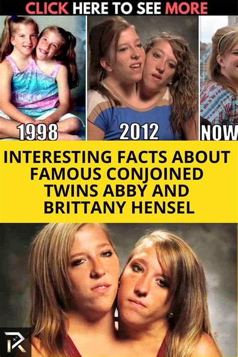 Conjoined Twins Abby And Brittany Hensel Facts Hot Sex Picture