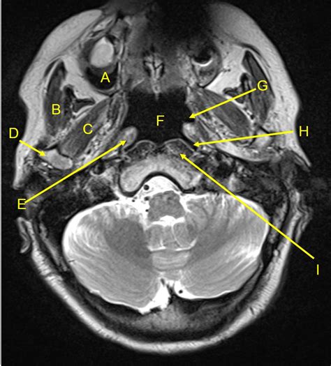 Quiz 4 Radiology Cases