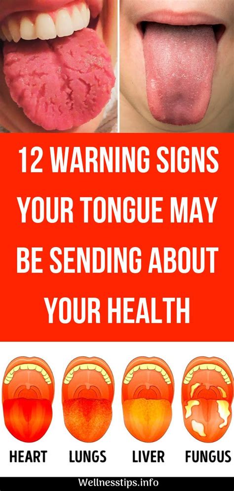 Read On To Discover Some Of The Warning Signs Your Tongue May Be Sending And Learn What To Look
