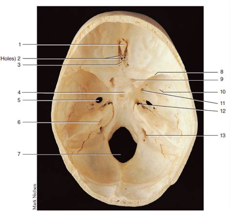 What Is The Floor Of Cranial Cavity Labeled