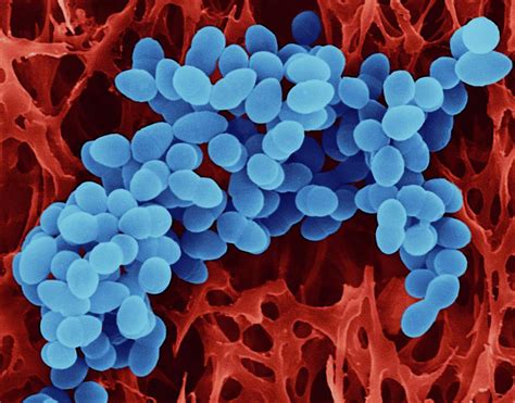Staphylococcus Aureus 23 Photograph By Dennis Kunkel Microscopy Science Photo Library Pixels
