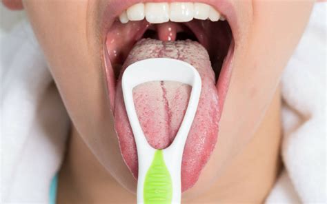 That's tip of the tongue phenomenon, and it is a failure of memory retrieval. How to Treat White Tongue and Make It Healthy | Health ...