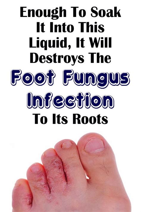 Enough To Soak It Into This Liquid It Will Destroys The Foot Fungus