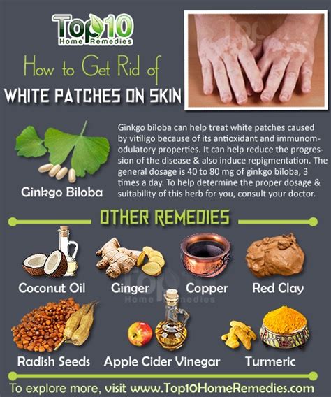 They might be difficult to spot early on and multiply quickly. How to Get Rid of White Patches on Skin, Vitiligo | Top 10 ...