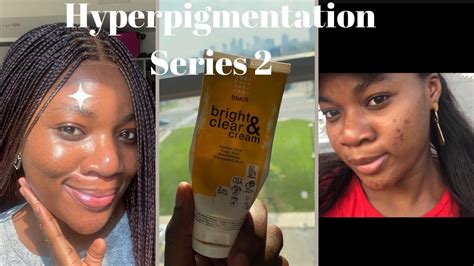 Touch Bright And Clear Cream Review Dark Spots And Hyperpigmentation