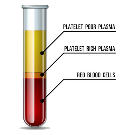 Platelet Rich Plasma Therapy Spartanburg Regional