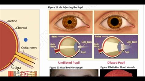 Oat Anatomy Of The Eye Cornea Aqueous Humor Lens Vitreous Humor