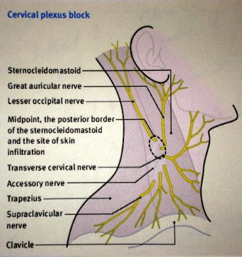 The Use Of The Superficial Cervical Plexus Block In The Drainage Of