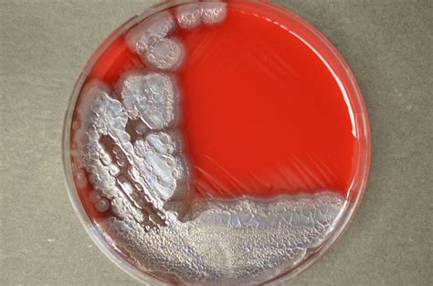 Best 25 Pseudomonas Aeruginosa Ideas On Pinterest Types Of Bacterial