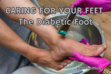 Diabetes And Your Feet