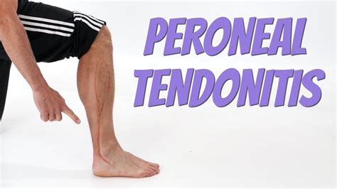 Peroneal Tendinopathy Carolina Regional Orthopedics