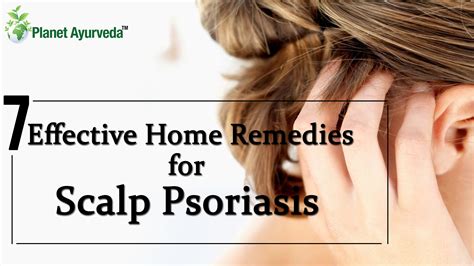 7 Effective Home Remedies For Scalp Psoriasis