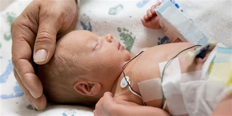 Differences Between Term And Preterm Newborns Penn Medicine Lancaster