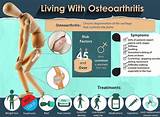 Exercise Program Hip Osteoarthritis