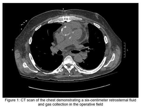 May 2022 Case Of The Month Doctor Fungus